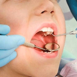 علائم-پوسیدگی-دندان